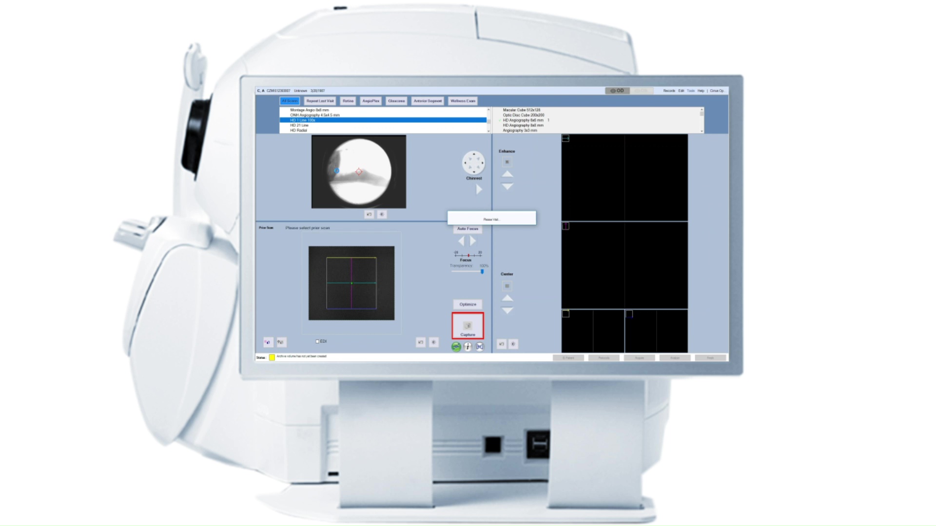 Image illustrant une Tomographie en Cohérence Optique